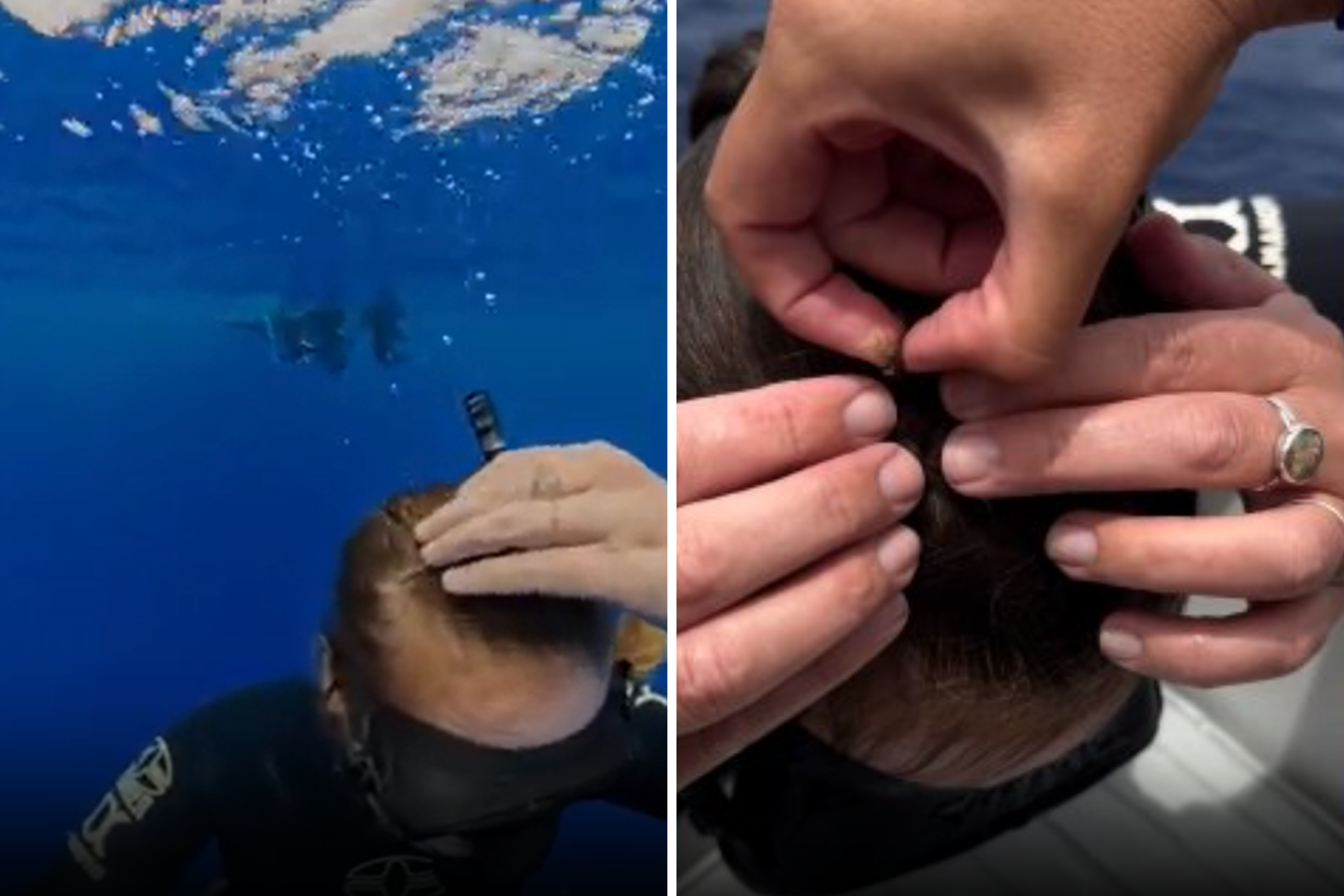 Woman finds crab in her hair.