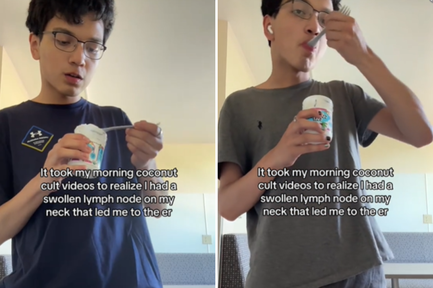 TikTok video to ER