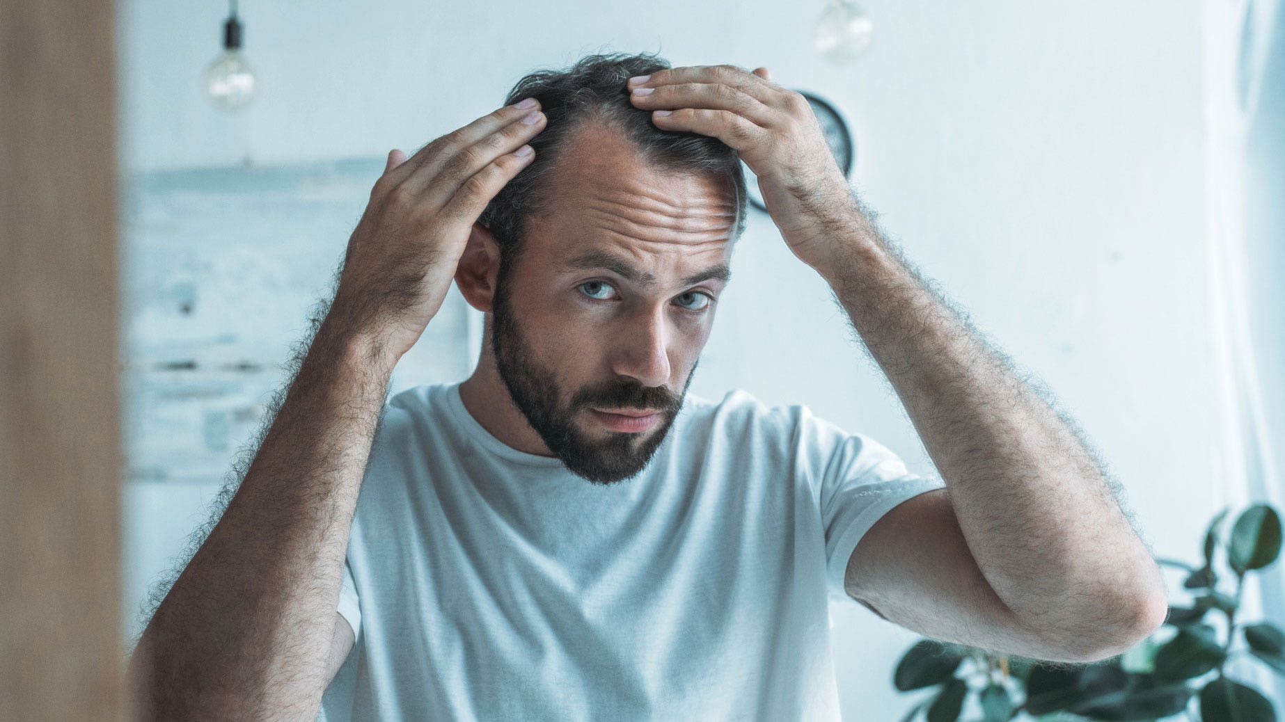 'Promising' stem cell therapy for hair loss could be available in five years