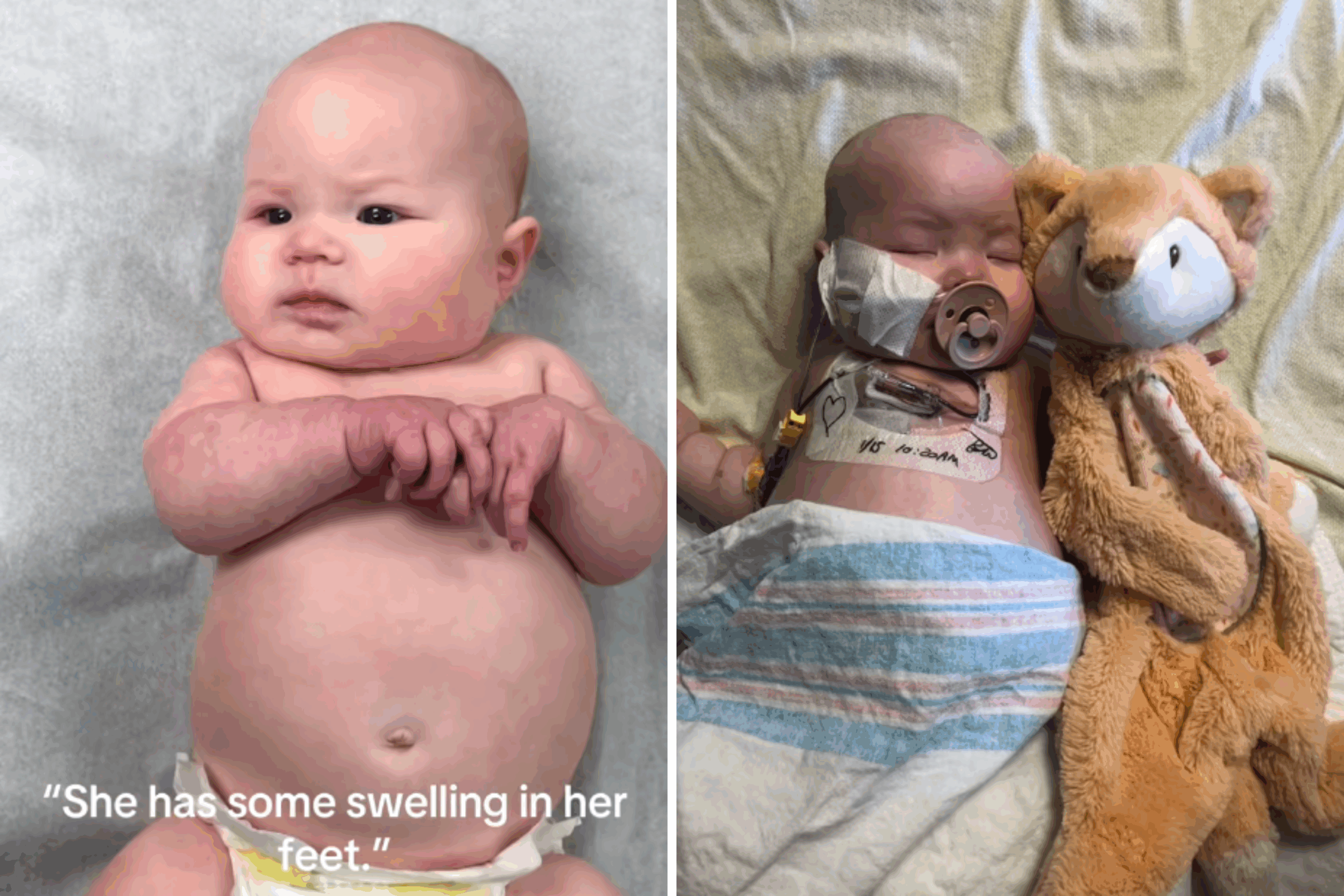 Neuroblastoma diagnosis