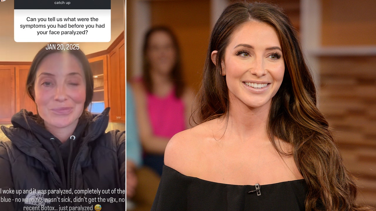 Bristol Palin says facial paralysis is 70% back to normal after diagnosis