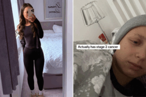 Katie before and after